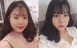 "Mượn" ảnh người khác, kể chuyện drama để khoe nhan sắc sau phẫu thuật, cô gái bị "vạch mặt" giữa chốn đông người