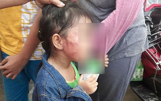 Bố của bé gái 5 tuổi bị bảo mẫu tát liên tiếp vào mặt, dọa lấy kéo cắt lưỡi: Cô ấy cũng đáng thương