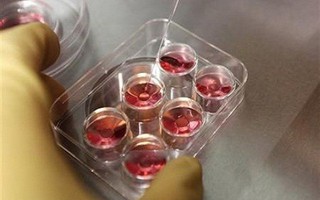 Thêm một điều kỳ diệu, bé trai chào đời khỏe mạnh từ trứng và tinh trùng đông lạnh của vợ chồng hiếm muộn