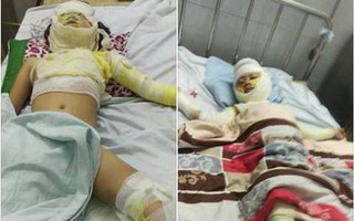 Bố nướng mực cháy nhà khiến con 2 tuổi tử vong, 3 người khác nhập viện