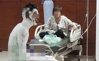 Cãi nhau với vợ, nam thanh niên tẩm xăng, ôm vợ tự thiêu