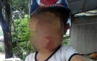 Yên Bái: Bé trai 5 tuổi tử vong bất thường sau khi nhập viện cắt Amidan