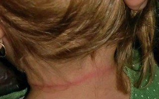 Tỉnh giấc thấy mái tóc mình bị mắc kẹt, nhìn về hướng con, mẹ hoàn toàn sốc trước những gì đập vào mắt