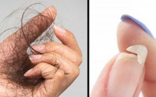 10 thay đổi trên cơ thể cảnh báo tình trạng sức khỏe mà bạn cần chú ý