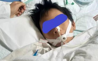 Người lớn không để ý, bé trai 10 tuổi rơi vào hôn mê sâu, nguy cơ sống thực vật vì 3 cốc rượu gạo