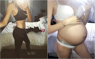 Bụng phẳng lì khiến cô gái trẻ không hề biết mình mang thai gần 9 tháng cho tới khi bác sĩ thực hiện việc này