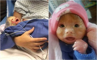 Mong đợi ngày con gái chào đời, mẹ lặng người khi lần đầu nhìn thấy khuôn mặt con