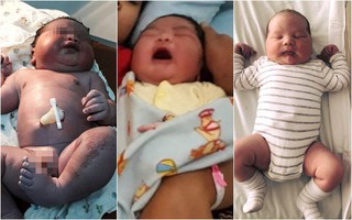 Những bé sơ sinh vừa chào đời đã sở hữu cân nặng kỷ lục bằng trẻ nuôi vài tháng