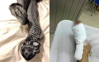 Sự thật đằng sau câu chuyện vợ trẻ bị chồng đánh "nát chân" vì đi tất hình rắn sexy