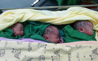 Cả thai kỳ mẹ Việt đi siêu âm thai đôi, đến khi mổ lấy ra 2 bé, bác sĩ phát hiện: "Ôi trời đất ơi, còn 1 bé nữa!"
