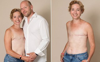 Bà mẹ 3 con đã dũng cảm khoe ra bộ ngực trần với vết sẹo, nhưng lý do đằng sau mới là điều đáng nể