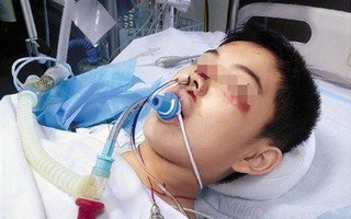 Đi ăn liên hoan cùng ông ngoại, bé trai bị "ép" uống rượu bia tới hôn mê bất tỉnh