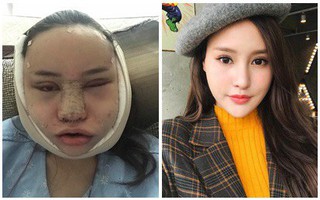 Cô gái trẻ khoe hình ảnh dao kéo nhìn thôi đã thấy đau, nhưng kết quả thì rất đỗi ngọt ngào