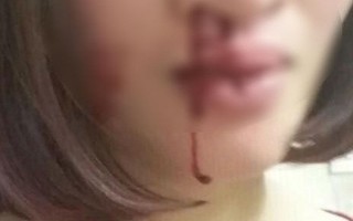 Vừa sảy thai 1 tuần, người vợ này chẳng những không được an ủi mà còn bị chồng tát bật máu trước mặt con nhỏ
