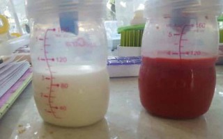 Hình ảnh sữa mẹ màu đỏ cho thấy sự thật đau đớn các mẹ phải trải qua khi tắc sữa
