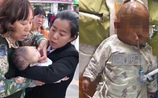 Bé sơ sinh rơi vào hôn mê sau khi bị bé gái 11 tuổi ném quả táo từ tầng 24 chung cư vào đầu