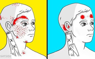 7 sai lầm trong ăn uống có thể gây đau đầu và đau nửa đầu nghiêm trọng