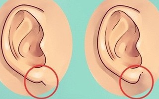 Nhìn tai bắt bệnh: Những dấu hiệu nguy hiểm bạn không ngờ
