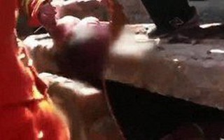 Bị đẻ rơi trong hố nước thải, bé sơ sinh sống sót thần kỳ