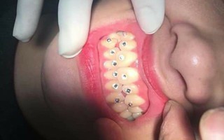 "Nụ cười" của nữ khách hàng khiến nha sĩ giật mình, thảng thốt