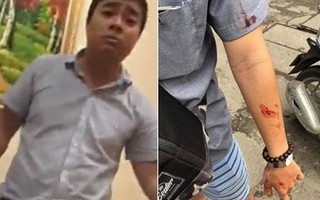 Hà Nội: Giám đốc đánh nữ sinh viên nhập viện vì đến đòi lại tiền cọc sau một tháng không được nhận lớp gia sư