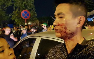 Hà Nội: Hai vợ chồng chở con nhỏ bị hành hung sau va chạm nhỏ với ô tô, lái xe chui trong xe cố thủ