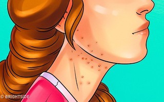 9 dấu hiệu bạn đang ăn quá nhiều đường, phải thay đổi ngay để bảo vệ cơ thể