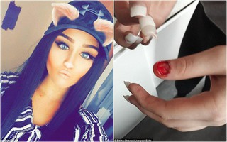 Chỉ vì một thói quen làm đẹp, cô gái nhận hậu quả đau đớn mất luôn cả móng tay