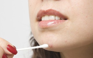 Những "lầm tưởng" khi trị mụn ai cũng hay mắc phải khiến mụn mãi không hết