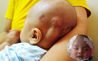 Tiếng khóc xé lòng của bé trai hơn 5 tháng tuổi mắc bệnh não úng thủy