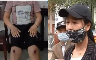Sự thật phẫn nộ đằng sau đầu gối bầm tím, rớm máu của 30 em học sinh tiểu học