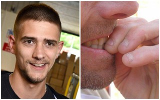 Thói quen cắn móng tay mọi lúc mọi nơi khiến ông bố 2 con suýt mất mạng vì điều này