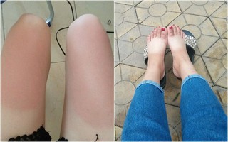 Những hình ảnh "tàn nhẫn" chứng minh mùa hè là mùa tàn phá nhan sắc chị em