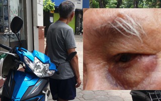 Người lái xe ôm bị nữ quái siết cổ để cướp ở Hà Nội: "Tôi đã lường trước vì sợ bị bỏ thuốc mê"