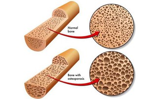Các xét nghiệm y tế ai cũng cần làm để phòng ngừa các bệnh nghiêm trọng