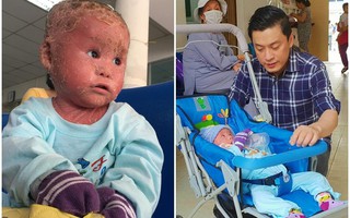 Ca sĩ Lam Trường đến thăm bé Bích - em bé bị vẩy ngứa da trăn trước khi bé nhập viện điều trị