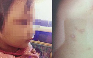 Người phụ nữ hành hạ dã man con riêng của bạn trai