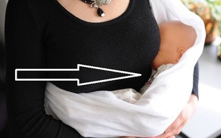 Bác sĩ Mỹ cảnh báo nguy cơ ít biết về địu em bé từng khiến trẻ tử vong