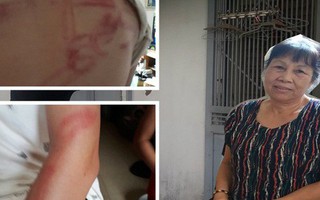 Vụ bố dùng tuýp sắt đánh con "như kẻ thù": Người mẹ lên tiếng