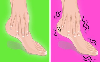 Hãy nhìn xuống đôi chân mình và xem nó đang cảnh báo bạn những vấn đề gì về sức khỏe