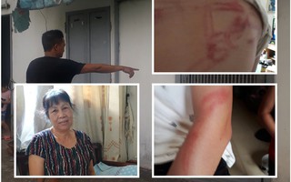 Chủ tịch thành phố Hà Nội yêu cầu làm rõ vụ 2 bé gái tố bị bố đẻ bạo hành dã man