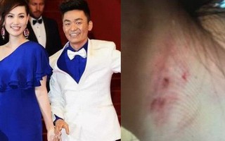 Vợ "Ảnh đế Trung Quốc" tố ngược chồng bao nuôi "tiểu tam", đánh đập bạo hành gây thương tích