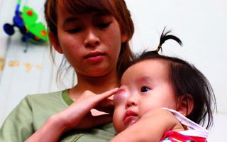 Em bé 2 tuổi ở Cà Mau bị u mắt nguy hiểm, bố mẹ nghèo cố tìm cách cứu con trong tuyệt vọng