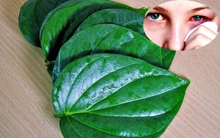 Dùng lá trầu không để xông khi đau mắt đỏ: Cẩn thận bệnh nặng càng thêm nặng!