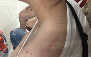 TP.HCM: Nam thanh niên 19 tuổi bị nhóm người lạ mặt tấn công cướp xe máy, điện thoại cùng 100 triệu đồng rồi bắt ký giấy nợ 400 triệu đồng