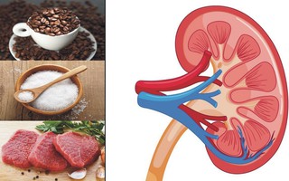 7 loại thực phẩm có thể gây hại cho thận mà bạn tuyệt đối không nên ăn nhiều