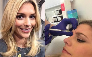 Lắng nghe những chia sẻ thật nhất của cô nàng 28 tuổi quyết định tiêm Botox để cải thiện làn da
