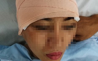 Hung thủ bắn người yêu cũ và nữ quản lý nhà hàng ở TP.HCM đã tử vong