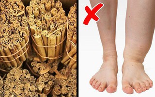 Các loại thực phẩm và đồ uống giúp cơ thể thoát khỏi bị giữ nước