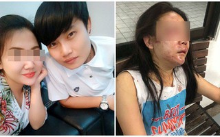 Yêu 7 năm, cô gái xinh đẹp vẫn bị người yêu dùng mũ bảo hiểm đánh bầm dập, biến dạng khuôn mặt khiến MXH dậy sóng